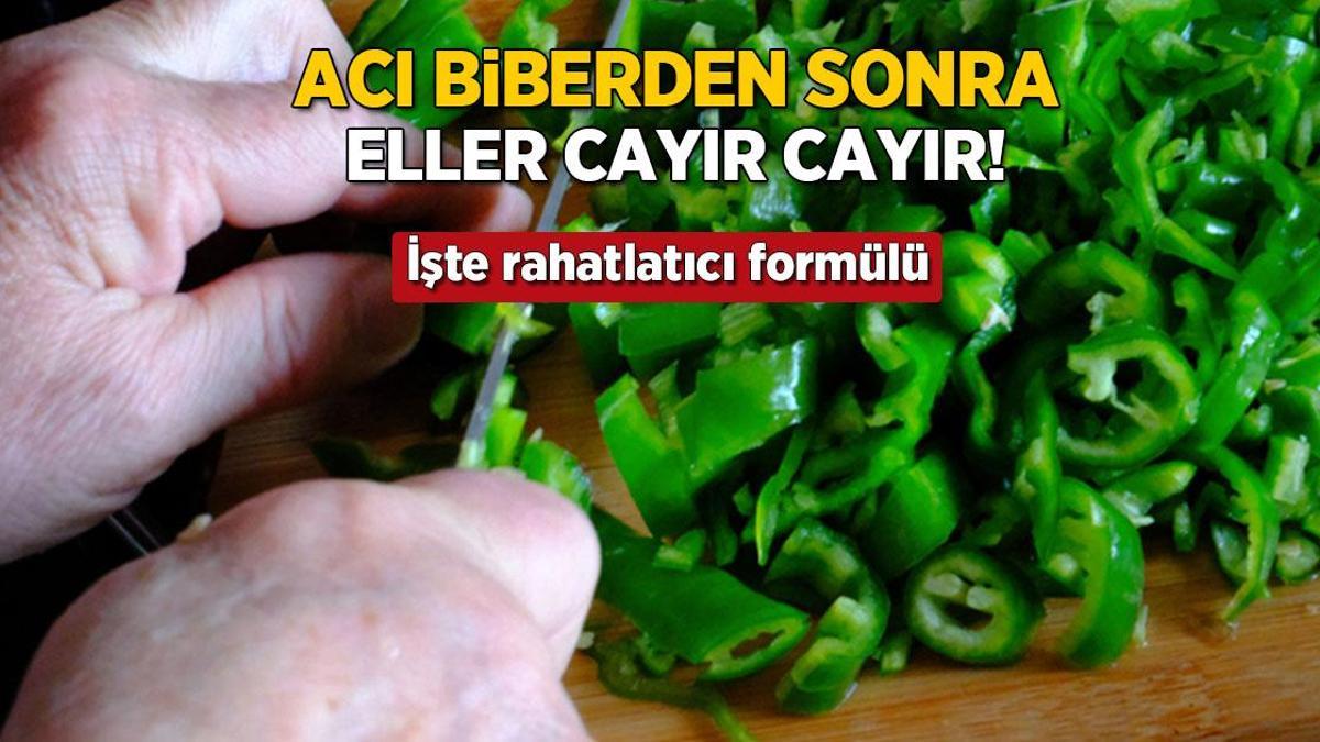 aci biber sonrasi eller cayir cayir yaniyor iste rahatlatici formulu kftBCiJN.jpg