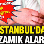 istanbulda-kizamik-alarmi-chpli-isimden-saglik-bakanligina-cagri-IdP2NmOx-1